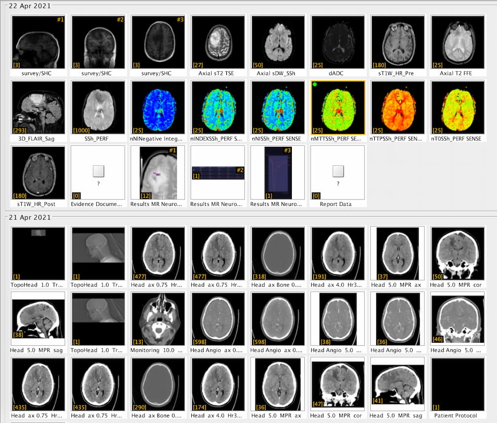 Image of lots of thumbnails of my head. All the images captured in the scans!