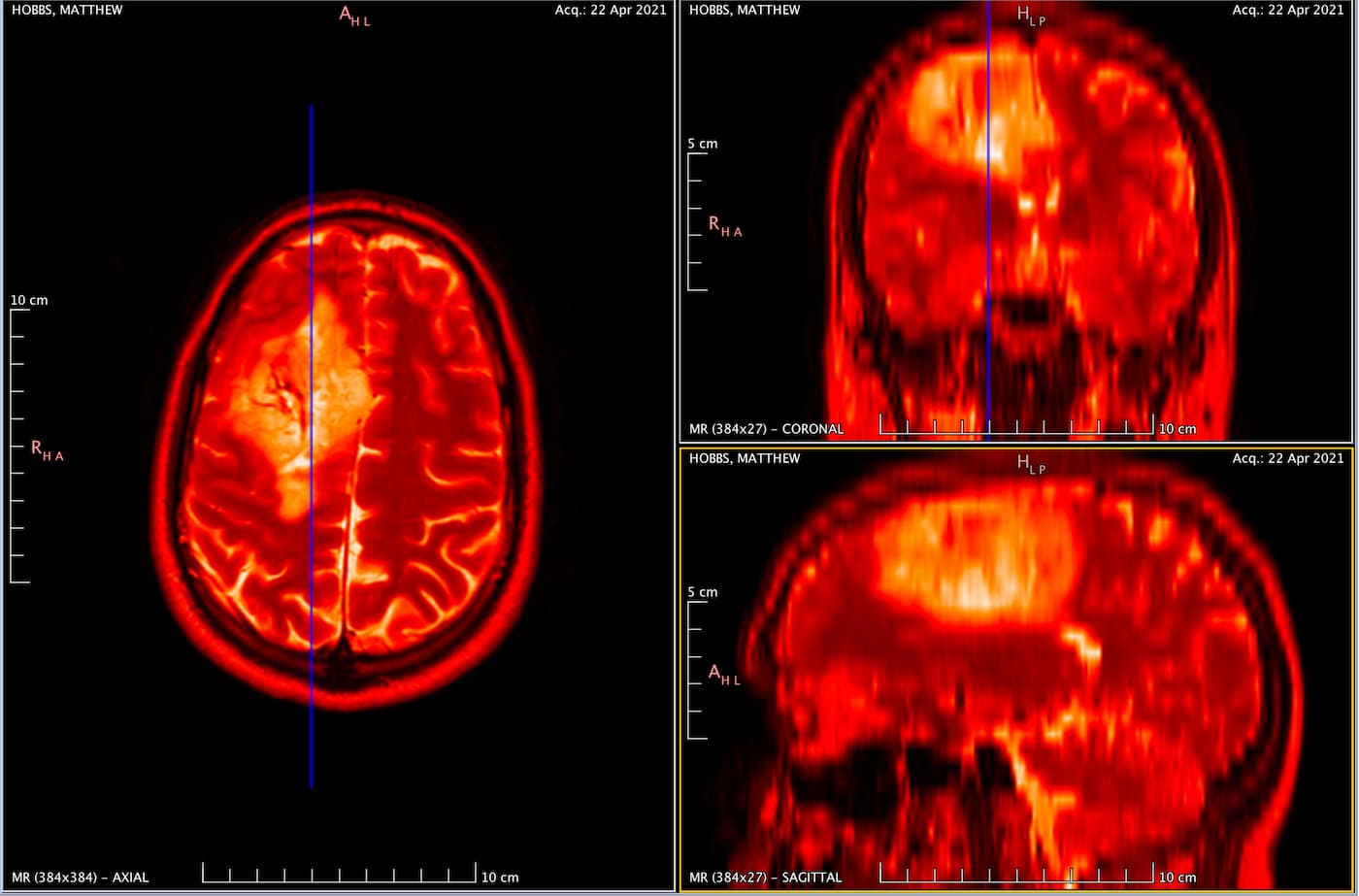 Image of the three navigation axis from my MRI scan.